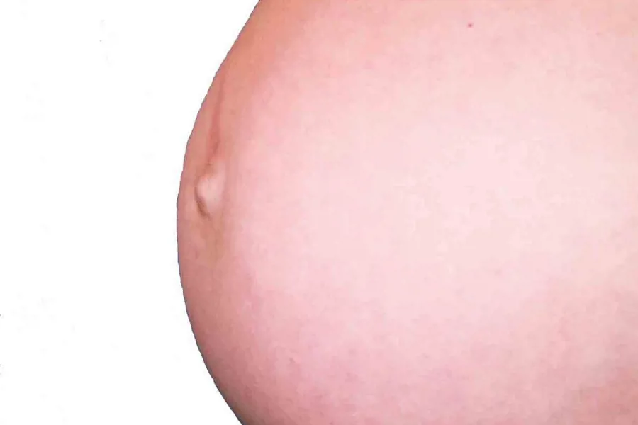 Gravid mage. Foto. 